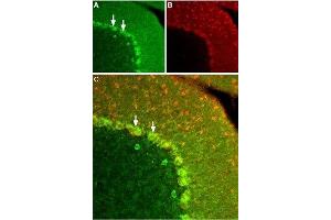 Expression of KISS1R in rat cerebellum - Immunohistochemical staining of frozen rat cerebellum section using Anti-KISS1 Receptor (GPR54) (extracellular) Antibody (ABIN7043294, ABIN7044548 and ABIN7044549), (1:100).