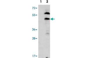 Western blot analysis of PDGFRL (arrow) using PDGFRL polyclonal antibody . (PDGFRL anticorps  (C-Term))