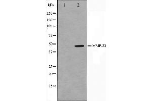 Western blot analysis on SK-OV3 cell lysate using MMP23 Antibody. (MMP23B anticorps  (C-Term))