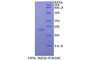 SDS-PAGE (SDS) image for Interferon, beta 1, Fibroblast (IFNB1) (AA 23-187) protein (His tag) (ABIN1878111)