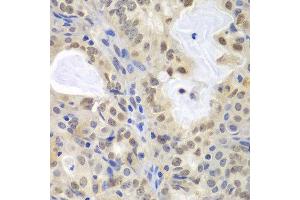 Immunohistochemistry (IHC) image for anti-Minichromosome Maintenance Complex Component 3 (MCM3) (AA 1-295) antibody (ABIN3021327)
