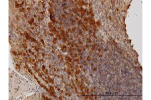Immunoperoxidase of monoclonal antibody to BAG1 on formalin-fixed paraffin-embedded human tonsil.