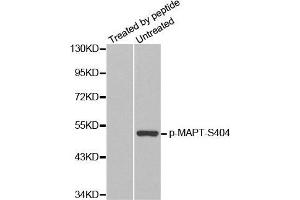 Western Blotting (WB) image for anti-Microtubule-Associated Protein tau (MAPT) (pSer404) antibody (ABIN3019704) (MAPT anticorps  (pSer404))
