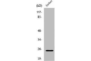 Western Blot analysis of Jurkat cells using Rit1 Polyclonal Antibody (RIT1 anticorps  (C-Term))