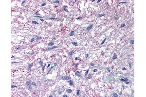 Anti-GPR50 antibody IHC of human pituitary. (GPR50 anticorps  (C-Term))