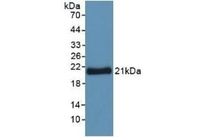 Detection of Recombinant YWHAz, Human using Polyclonal Antibody to Tyrosine 3/Tryptophan 5 Monooxygenase Activation Protein Zeta (YWHAz) (14-3-3 zeta anticorps  (AA 1-245))
