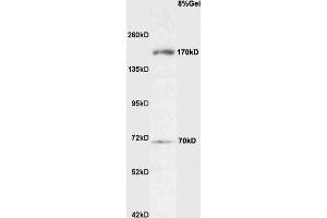 Rat brain lysate probed with Anti Robo4 Polyclonal Antibody, Unconjugated  at 1:3000 for 90 min at 37˚C.