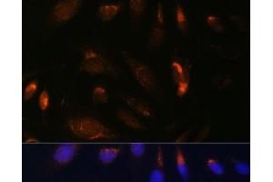 Immunofluorescence analysis of U-2 OS cells using IKK alpha Polyclonal Antibody at dilution of 1:100. (IKK alpha anticorps)