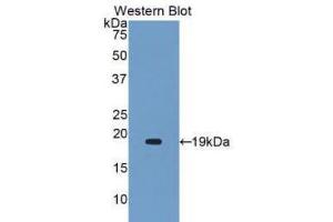 Western Blotting (WB) image for anti-Alpha2 Antiplasmin (SERPINF2) (AA 340-491) antibody (ABIN1172474) (alpha 2 Antiplasmin anticorps  (AA 340-491))