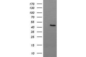 Image no. 2 for anti-butyrobetaine (Gamma), 2-Oxoglutarate Dioxygenase (Gamma-butyrobetaine Hydroxylase) 1 (BBOX1) antibody (ABIN1496820) (BBOX1 anticorps)