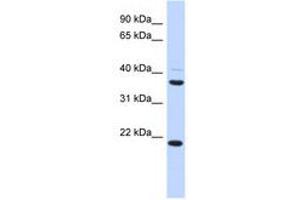 Image no. 1 for anti-Transmembrane Protein 74 (TMEM74) (AA 215-264) antibody (ABIN6741230) (TMEM74 anticorps  (AA 215-264))