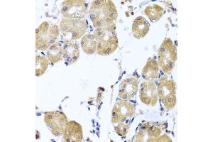 Immunohistochemistry of paraffin-embedded human stomach using RHOB antibody (ABIN5975835) at dilution of 1/100 (40x lens). (RHOB anticorps)