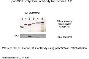 Image no. 1 for anti-Histone Cluster 1, H1c (HIST1H1C) (N-Term) antibody (ABIN410164) (HIST1H1C anticorps  (N-Term))
