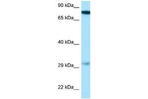 WB Suggested Anti-Gucy1b3 Antibody Titration: 1. (GUCY1B3 anticorps  (N-Term))