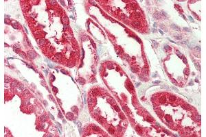 Rabbit Anti-FICD antibody Catalog Number: ARP46826 Formalin Fixed Paraffin Embedded Tissue: Human Kidney Primary antibody Concentration: 1:200 Secondary Antibody: Donkey anti-Rabbit-Cy3 Secondary Antibody Concentration: 1:200 Magnification: 20x Exposure Time: 0.