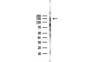 anti-Myelodysplasia Syndrome 1 (MDS1) (Internal Region) antibody