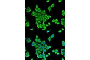 Immunofluorescence analysis of U2OS cells using CIAPIN1 antibody. (CIAPIN1 anticorps  (AA 1-312))