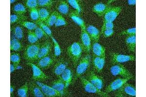 IF analysis of TEK using anti-TEK antibody (ABIN7600762). (TEK anticorps  (AA 23-616))