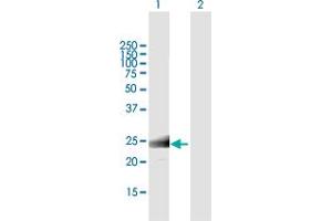 Western Blot analysis of MS4A12 expression in transfected 293T cell line by MS4A12 MaxPab polyclonal antibody.