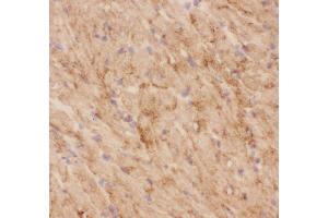 Anti-GLUT4 Picoband antibody,  IHC(F): Mouse Cardiac Muscle Tissue