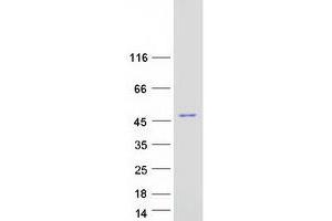 Validation with Western Blot