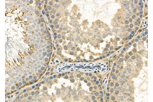 ABIN6263917 and ABIN6272379 at 1/100 staining Rat testis tissue by IHC-P.