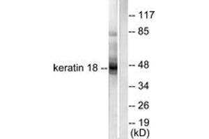 Western blot analysis of extracts from HeLa cells, using Keratin 18 Antibody. (Cytokeratin 18 anticorps  (AA 381-430))