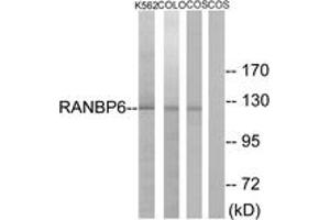Western blot analysis of extracts from COS7/K562/COLO cells, using RANBP6 Antibody. (RANBP6 anticorps  (AA 800-849))