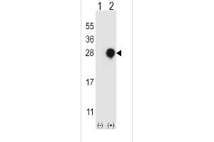 Western blot analysis of RGS4 using rabbit polyclonal RGS4 Antibody using 293 cell lysates (2 ug/lane) either nontransfected (Lane 1) or transiently transfected (Lane 2) with the RGS4 gene.