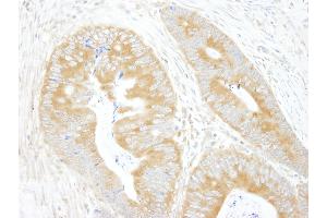 anti-Eukaryotic Translation Initiation Factor 3 Subunit A (EIF3A) (AA 860-910) antibody