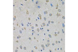 Immunohistochemistry of paraffin-embedded mouse brain using PTK7 antibody (ABIN6003571) at dilution of 1/100 (40x lens).