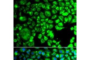 Immunofluorescence analysis of A549 cells using TBPL1 Polyclonal Antibody (TBPL1 anticorps)