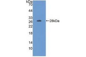 Detection of Recombinant FOLR1, Human using Polyclonal Antibody to Folate Receptor 1, Adult (FOLR1)