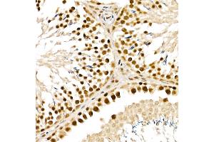 Immunohistochemistry of paraffin-embedded rat testis using  Rabbit pAb (ABIN6133085, ABIN6136806, ABIN6136807 and ABIN6215376) at dilution of 1:150 (40x lens). (ALKBH5 anticorps  (AA 245-394))