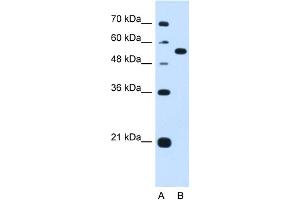 WB Suggested Anti-LMAN1 Antibody Titration:  1. (LMAN1 anticorps  (Middle Region))