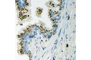Immunohistochemical analysis of LLGL2 staining in human prostate formalin fixed paraffin embedded tissue section. (LLGL2 anticorps)