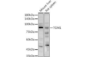 Western blot analysis of extracts of various cell lines, using TGM1 antibody (ABIN6129517, ABIN6149090, ABIN6149092 and ABIN6217322) at 1:1000 dilution. (TGM1 anticorps  (AA 100-280))
