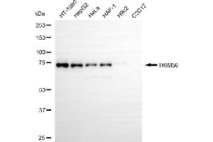 anti-Tripartite Motif Containing 56 (TRIM56) antibody