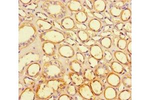 Immunohistochemistry of paraffin-embedded human kidney tissue using ABIN7158094 at dilution of 1:100 (PPIL5 anticorps  (AA 18-159))