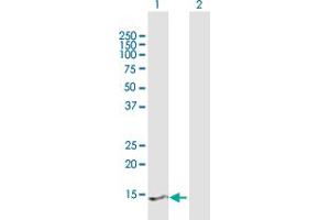 Western Blot analysis of PRY2 expression in transfected 293T cell line by PRY2 MaxPab polyclonal antibody. (PRY2 anticorps  (AA 1-147))