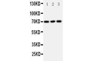 Western Blotting (WB) image for anti-Solute Carrier Family 6 (Neurotransmitter Transporter, serotonin), Member 4 (SLC6A4) (AA 7-24), (N-Term) antibody (ABIN3043084) (SLC6A4 anticorps  (N-Term))