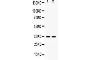 Western blot analysis of LFA3 expression in HELA whole cell lysates ( Lane 1) and K562 whole cell lysates ( Lane 2). (CD58 anticorps  (AA 29-215))