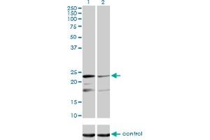 Western blot analysis of MRPL12 over-expressed 293 cell line, cotransfected with MRPL12 Validated Chimera RNAi (Lane 2) or non-transfected control (Lane 1).