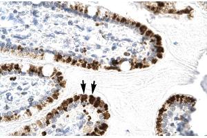 Human Intestine (E2F4 anticorps  (C-Term))