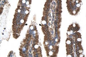 Image no. 1 for anti-Progesterone Receptor Membrane Component 1 (PGRMC1) (N-Term) antibody (ABIN6738268)