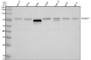 Western blot analysis of RACGAP1 using anti-RACGAP1 antibody (ABIN7606173).