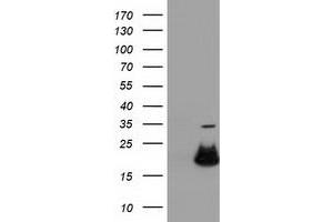 Western Blotting (WB) image for anti-Retinoblastoma Binding Protein 9 (RBBP9) antibody (ABIN1500628) (RBBP9 anticorps)