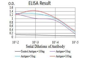 Black line: Control Antigen (100 ng),Purple line: Antigen (10 ng), Blue line: Antigen (50 ng), Red line:Antigen (100 ng)