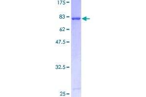 Image no. 1 for Tumor Protein P53 (TP53) (AA 1-393) protein (GST tag) (ABIN1323380)