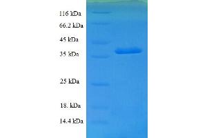 SDS-PAGE (SDS) image for Sorting Nexin 20 (SNX20) (AA 1-102), (partial) protein (GST tag) (ABIN5710392)